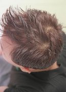 男性脱发的主要原因是什么呢2015-02-01